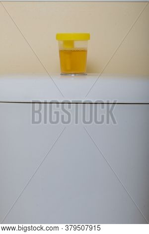 Urine In A Container For Analysis. Stands On The Toilet Cistern. Disposable Medical Polymeric Steril