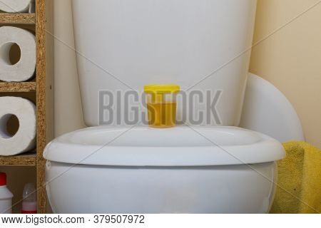 Urine In A Container For Analysis. Stands On The Toilet Seat. Disposable Medical Polymeric Sterile C