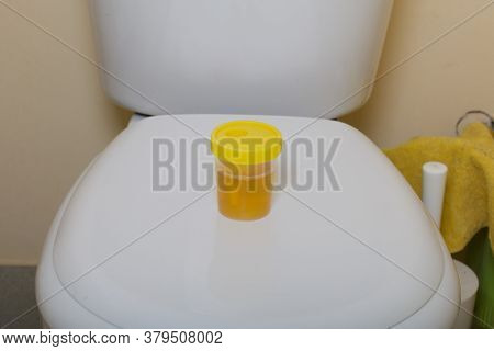 Urine In A Container For Analysis. Stands On The Toilet Lid. Disposable Medical Polymeric Sterile Co