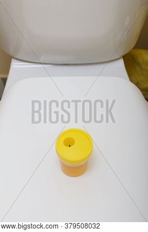 Urine In A Container For Analysis. Stands On The Toilet Lid. Disposable Medical Polymeric Sterile Co