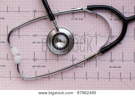 Stethscope Overlying Ecg/ekg