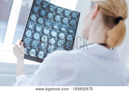 Providing radiograph before operation. Proficient experienced female neurosurgeon working at the x ray laboratory while examining brain radiograph and analyzing patient health