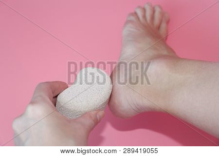 Pumice Stone For Foot Care. In The Photo A Woman Hand Holds A Pumice Near The Heel Of Her Foot. Remo