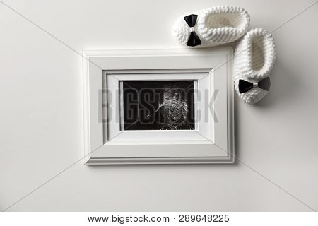 Ultrasound Photo Of Baby And Knitted Boots On White Background, Top View