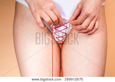 Hymenoplasty Restores The Membrane To A Pre-sexual State Hymenorrhaphy Or Surgery Is The Temporary S