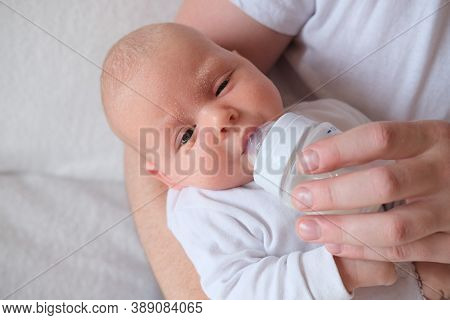 A Father Holds And Bottle Feeds His Newborn Baby. The Baby Has Seborrhea On His Face And Head.