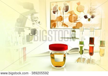 Test Tubes In Modern Pollution Research Facility - Urine Quality Test For Nitrite Or Urinary Tract I
