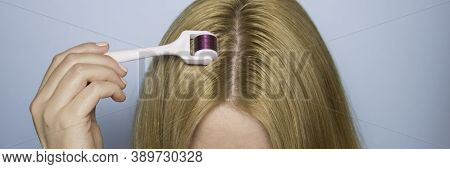Hand And Mesoroller In Hand On A Blue Background. Scalp And Skin Care, Healthy Hair.
