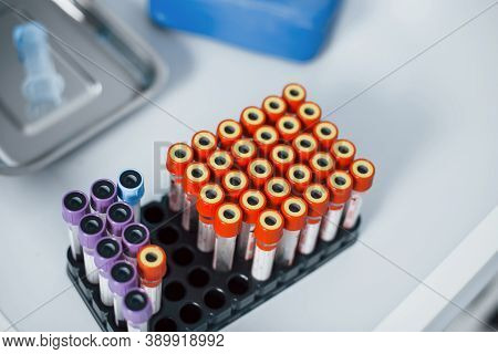 Top View Of Vials With Medical Experimental Liquid That Stands On White Surface.