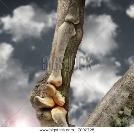 Bones