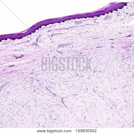 Histology of human tissue, show skin as seen under the microscope, 10x zoom.