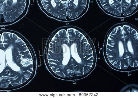research in medicine. CT scan of the patient.