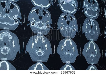 research in medicine. CT scan of the patient.