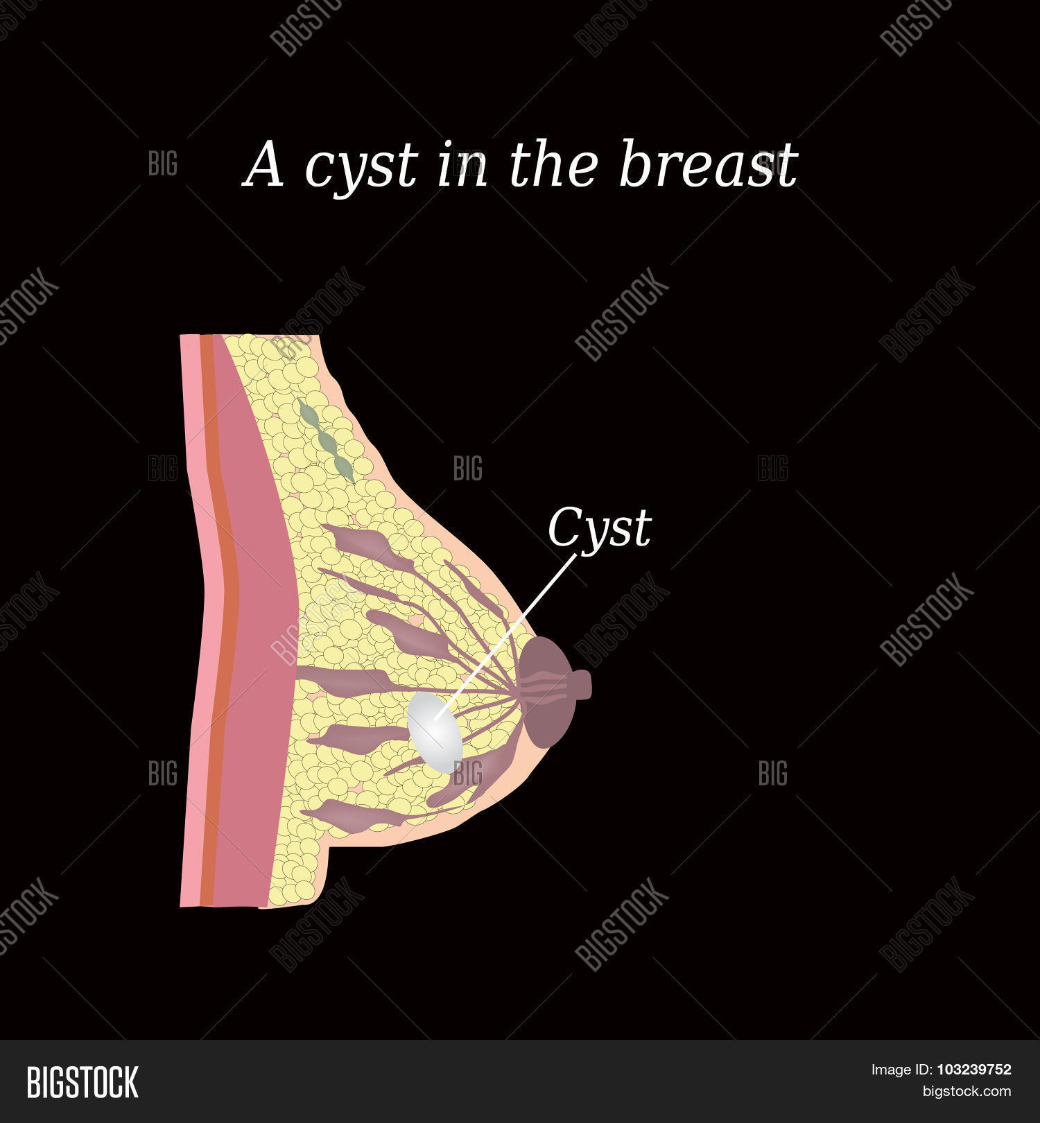 the structure of the breast. mammary gland.
